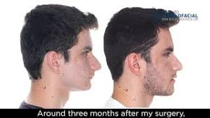 1693024176745