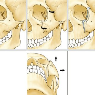1693087847664