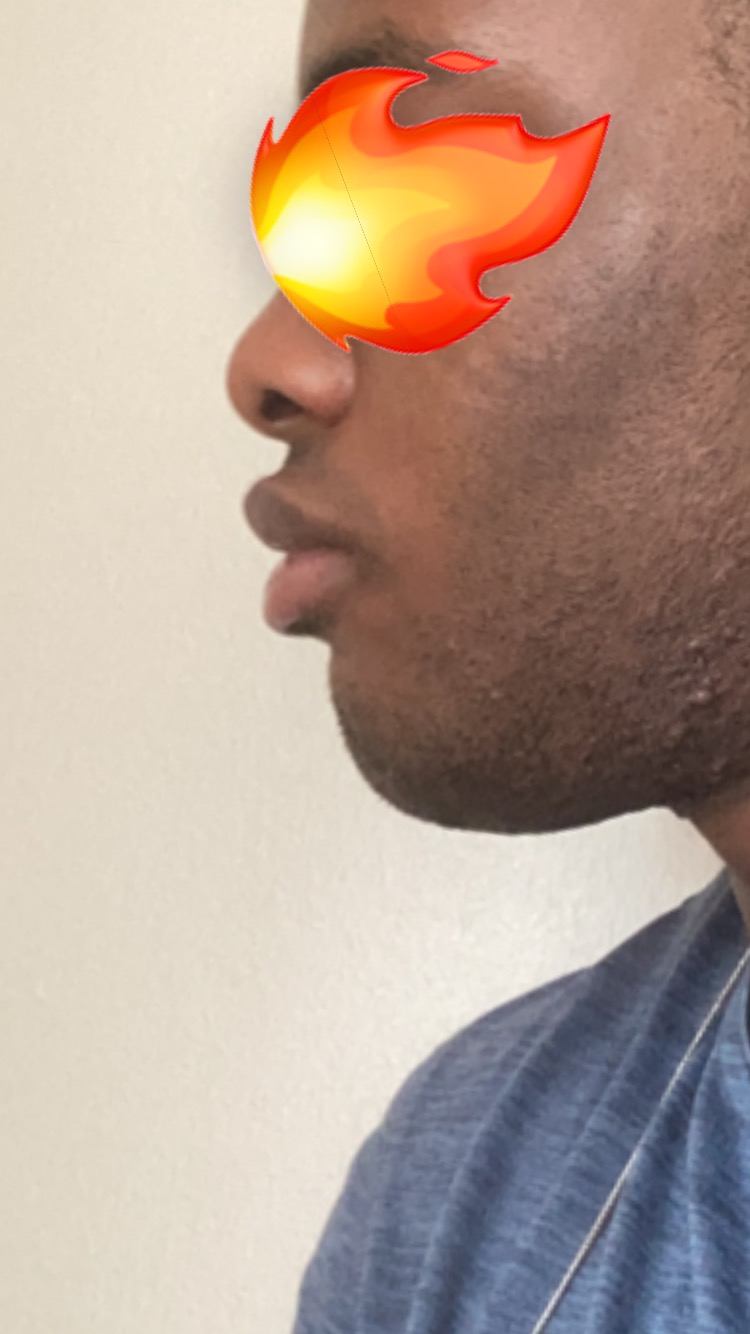 E4587F7F 2586 4ABA 8A75 8F7E6200503B