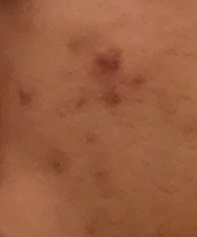 Cheek