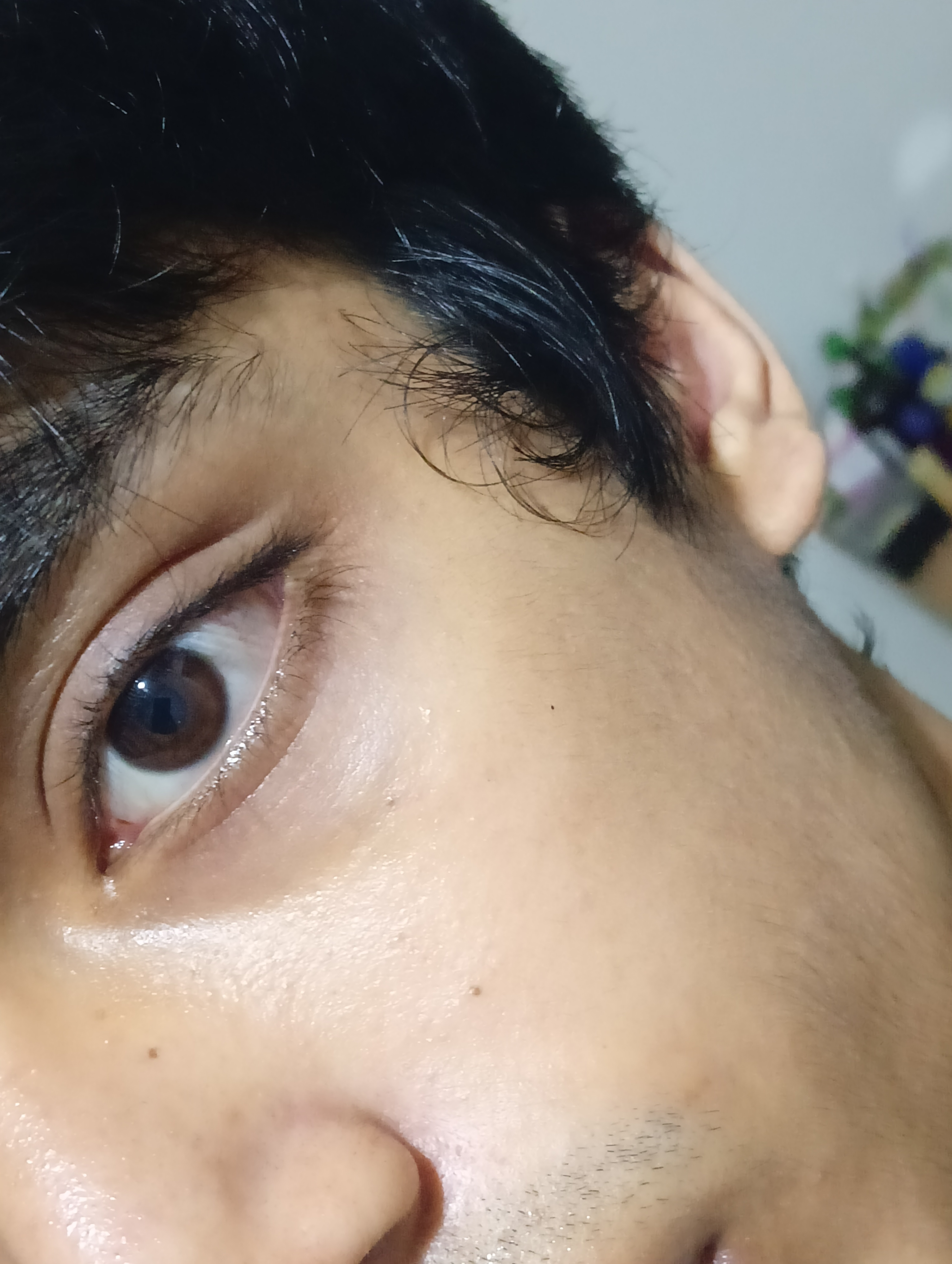 1000107818