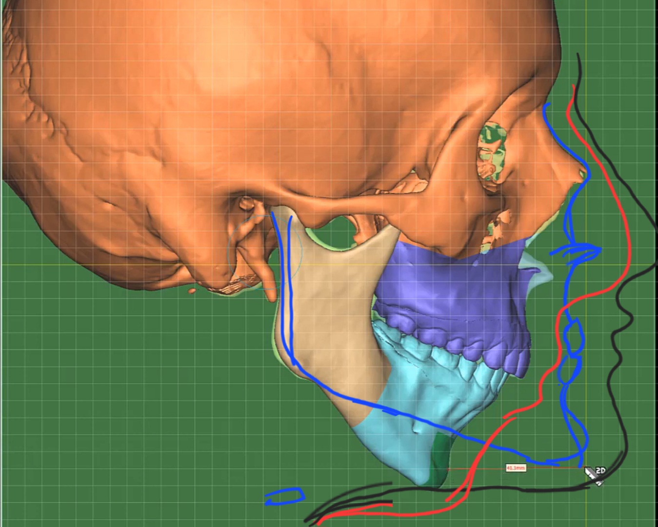 Screenshot 20230609 103322 YouTube