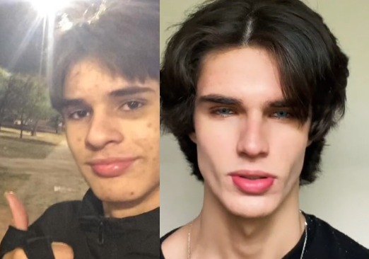 Co1otee before after