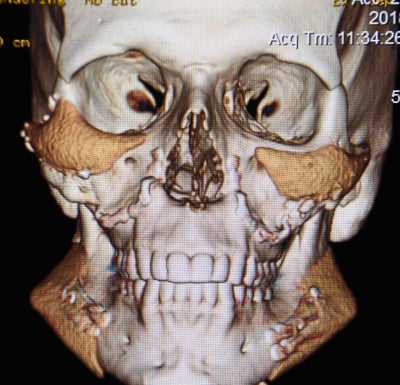 Userimage cc8a6013 83ae 4c13 9a31 00e2be5182e6