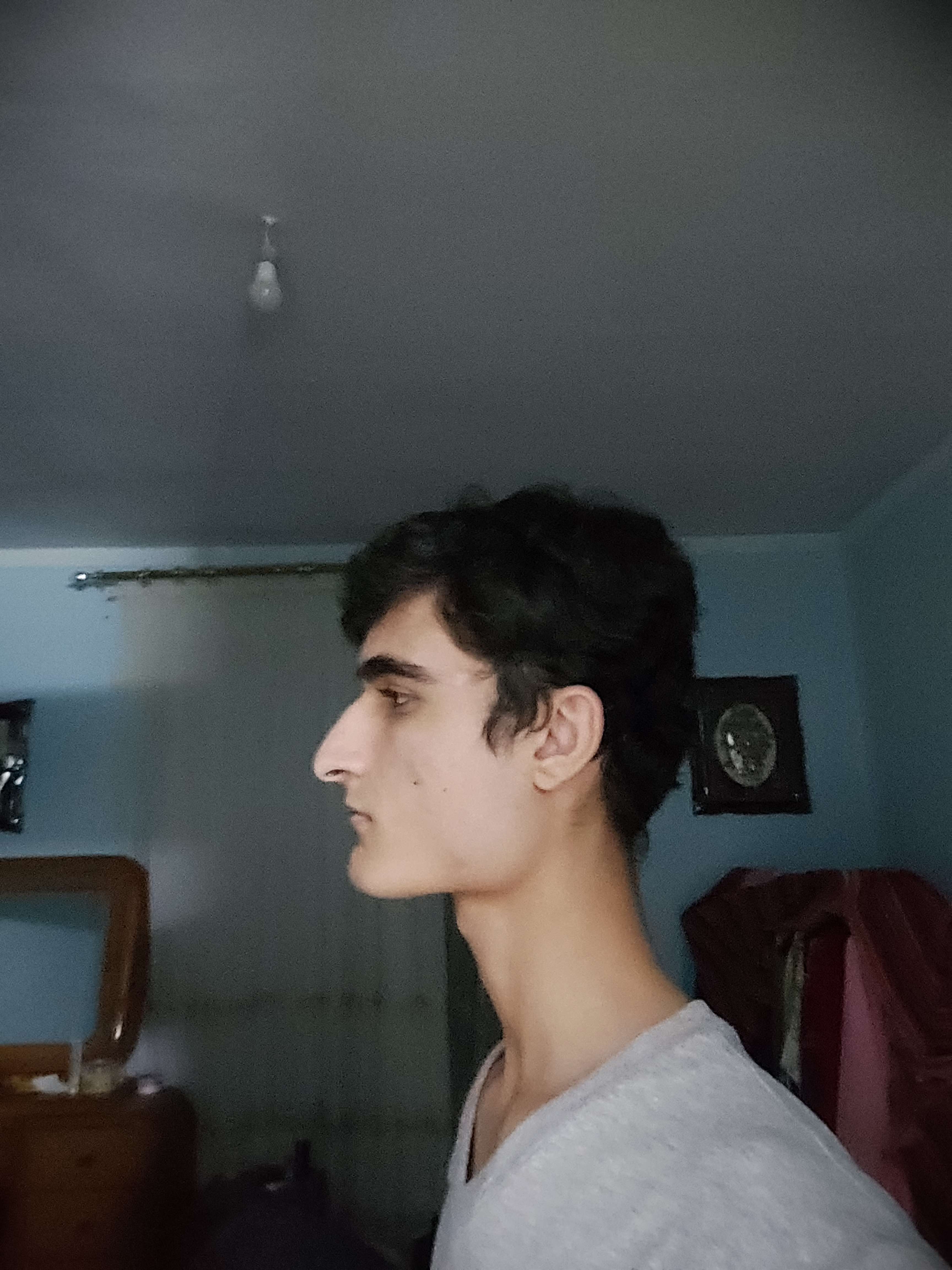 Face 3