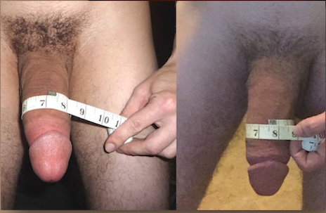 Testbite