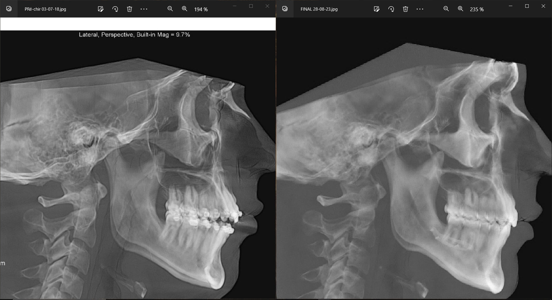 Comparative Skull 2018 to 2023