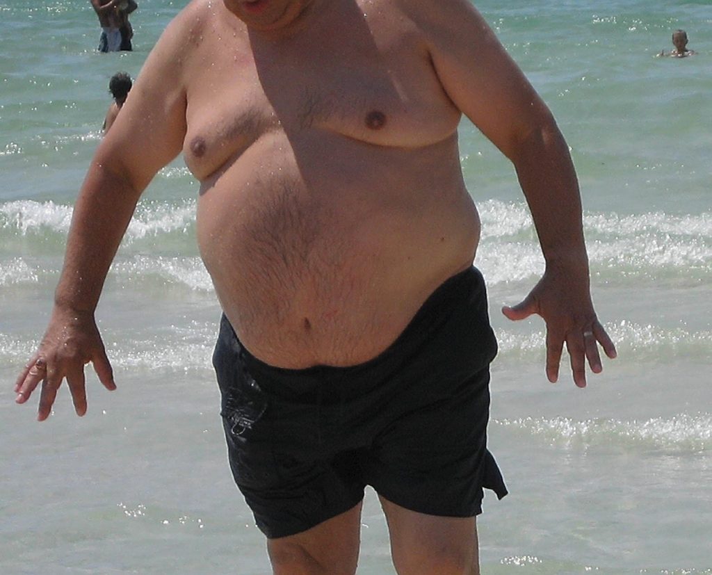 Obesity man 1024x827