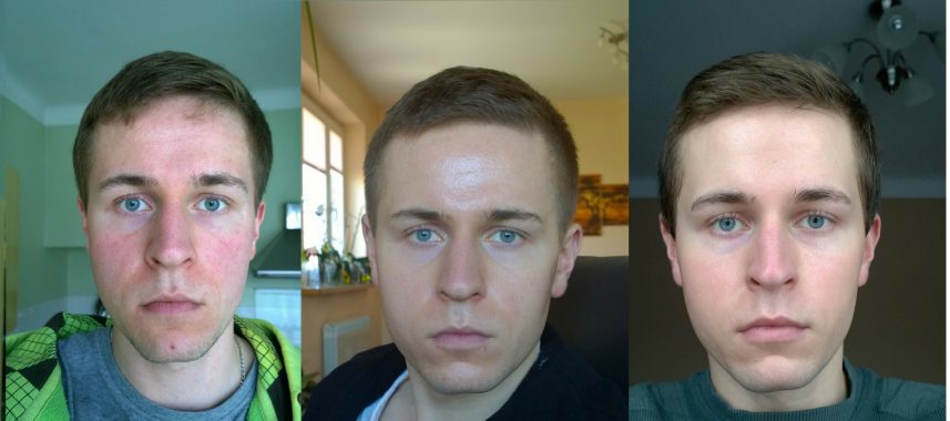 Urea skin dude e1501204473991