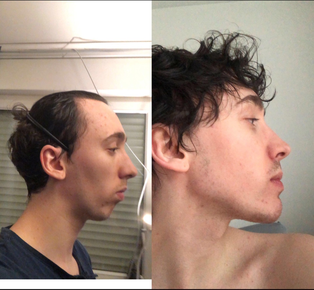 Screenshot 20230916 205926 Reddit