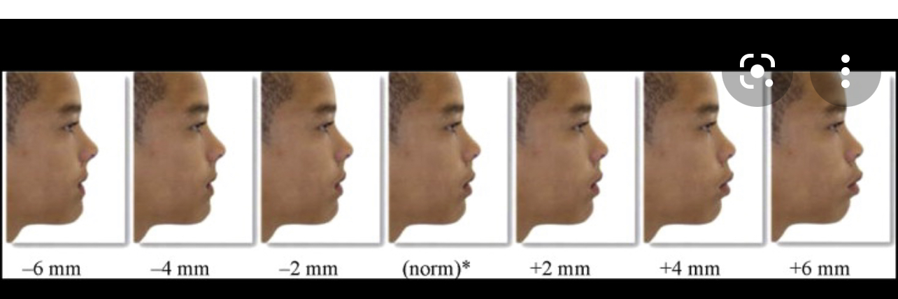 2713538 8E052CF9 0E28 4652 A886 45266151BD6F 1