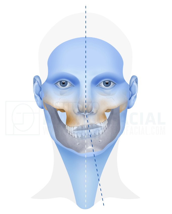 Asimetria marcadeagua e1567420367230 1