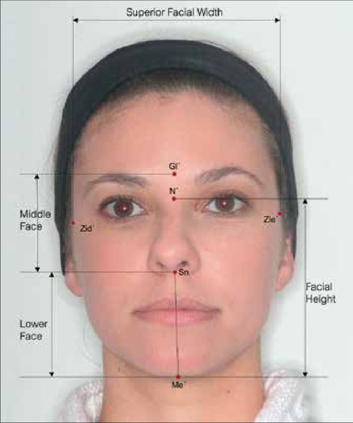 Proportional measures Facial Index Proportion between upper facial height and facial