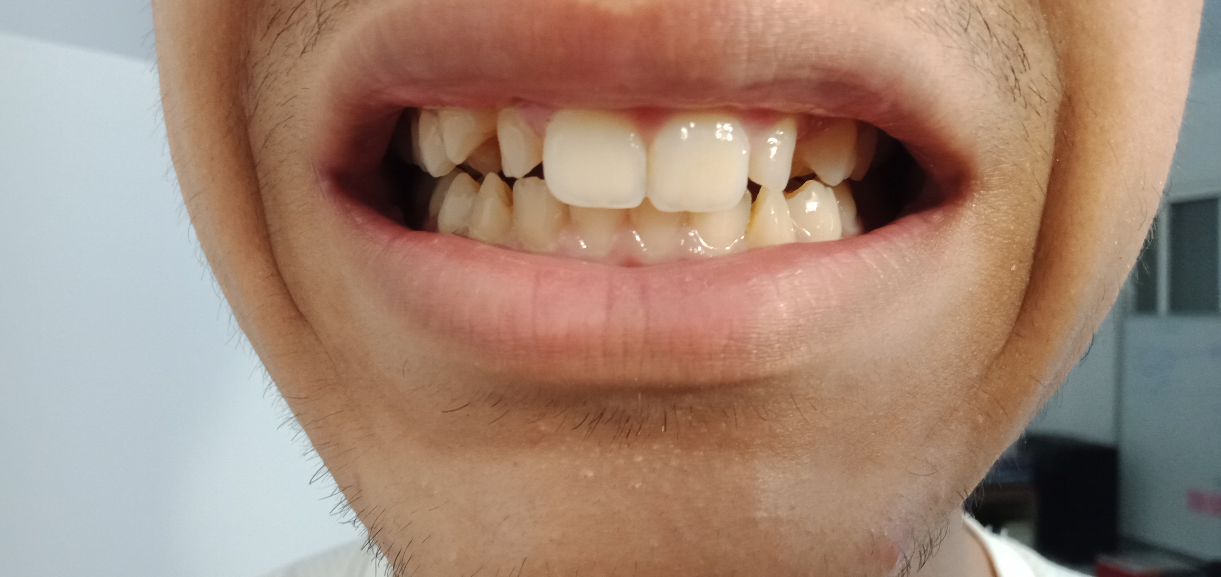 IMG20230928224055