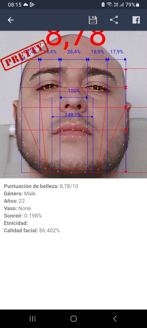 Screenshot_20230910_081513_Golden Ratio Face App - Beauty Analysis.jpg