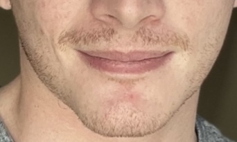 IMG 1900
