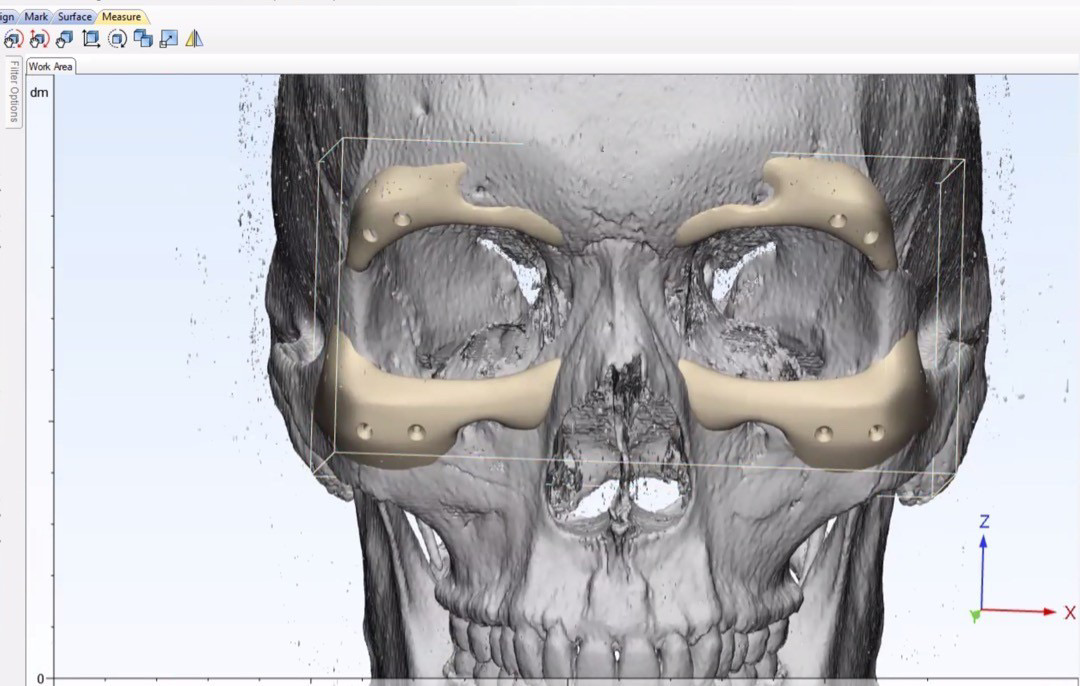 28754C05 D0D1 45EC 983F 47A40F724923