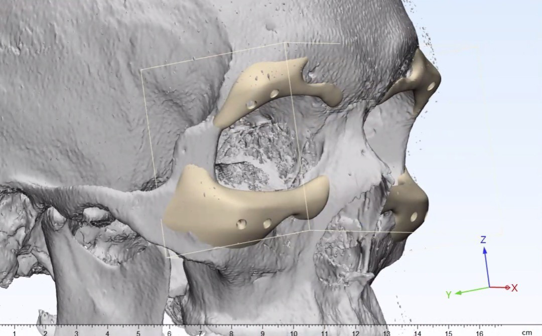 F19460CC BB1B 4A18 B79A 65BA044B1965