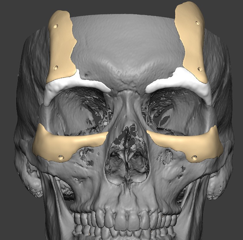 F840EF21 5E32 4617 9680 F423BDFBD5CA