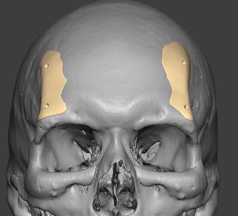 17238CB2 FBD3 4C91 BADA E29DE9D78C66
