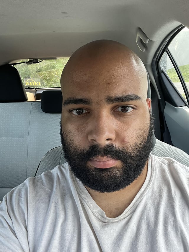 So the folks at r amiugly suggested i shave my head grow a v0 4mkeh961yde91