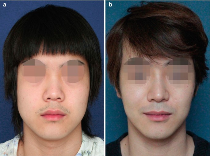 504000 1 En 3 Fig28 HTML