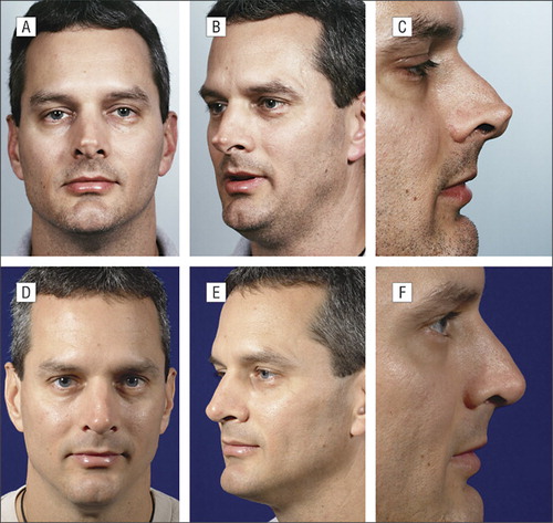 Images medium qoa70049f3