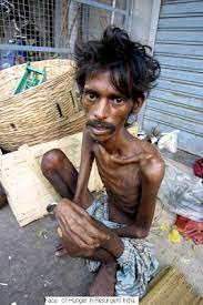 Haq's Musings: South Asia's War on Hunger Takes a Back Seat