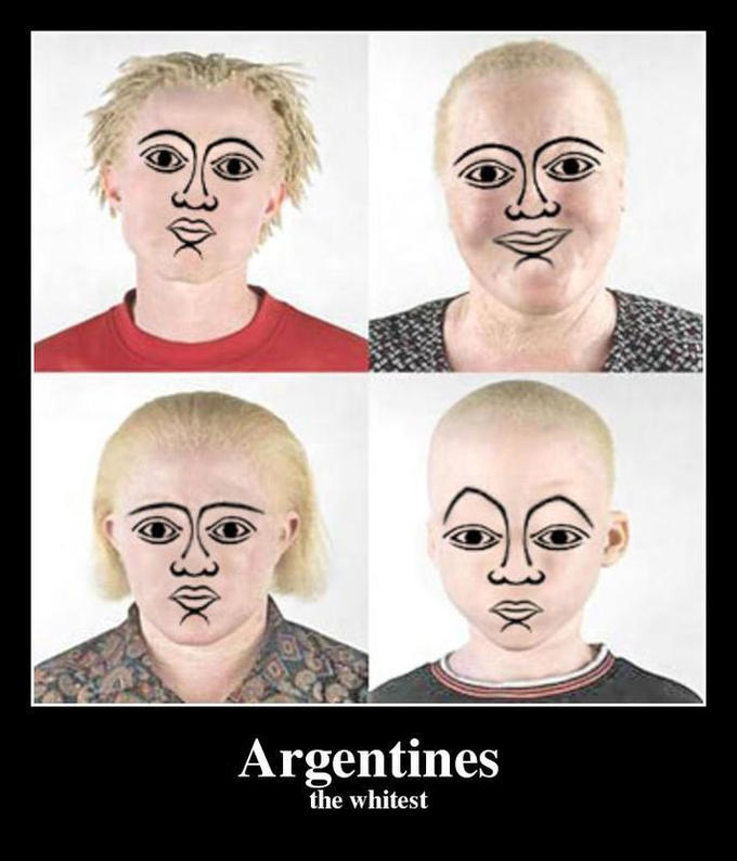 ArgentinaAlbinos