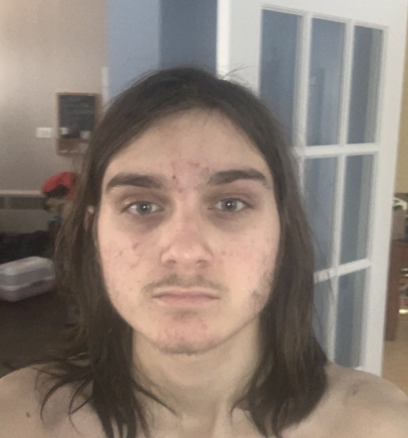 3331183 D1CD0460 722B 42C9 8C7C 5DC66A0CCB39