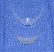 Chin Implant with lateral wings compared to a central button chin implant Dr Barry Eppley Ind
