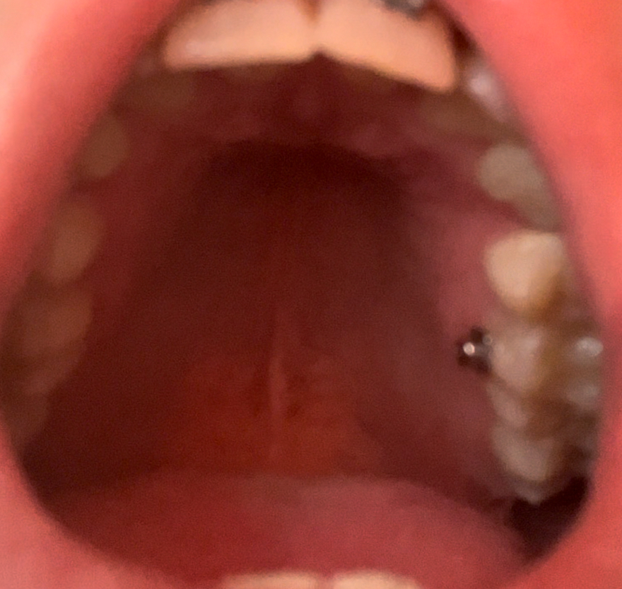 IMG 1748
