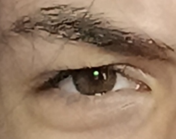 1000030994