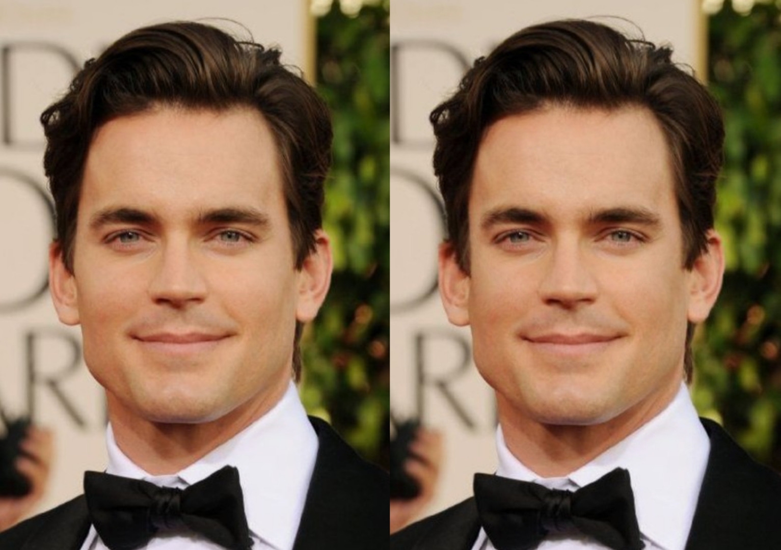 Bomer zygos2