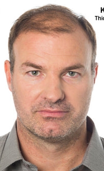 Hair fibers kerathik man before after 480x480 1