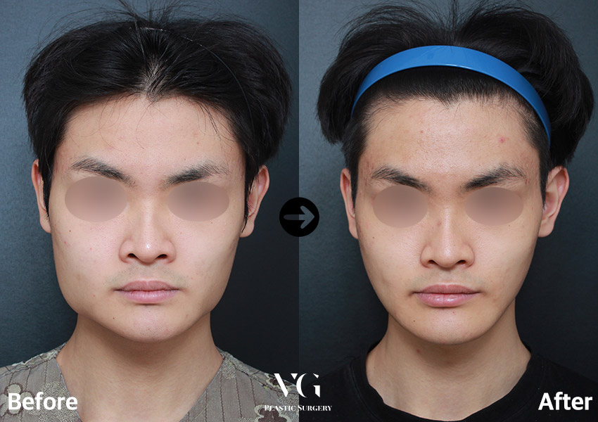 E74B923C 0072 42DE 95FB 820F6AD31C56