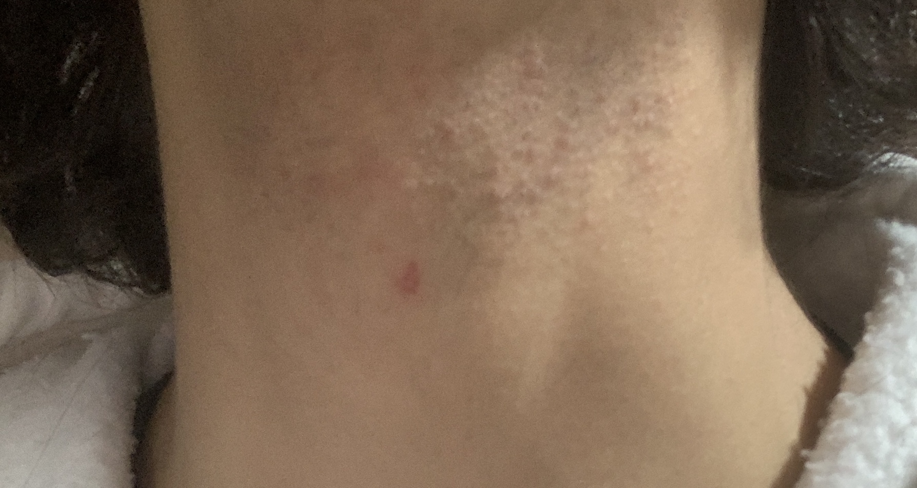 IMG 0825