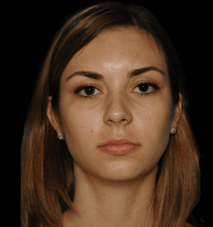 Dd 800w 850h 3 1 420x446