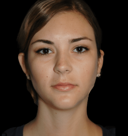 Dd 800w 850h 4 1 420x446 1