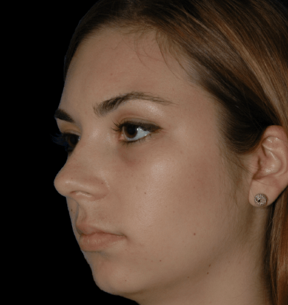 Dd 800w 850h 2 2 420x446