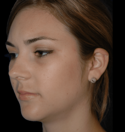 Dd 800w 850h 3 2 420x446