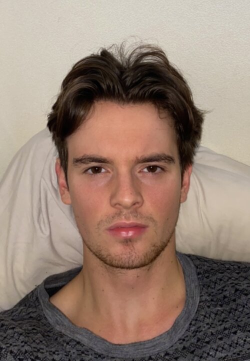 72kg No allergies.jpeg