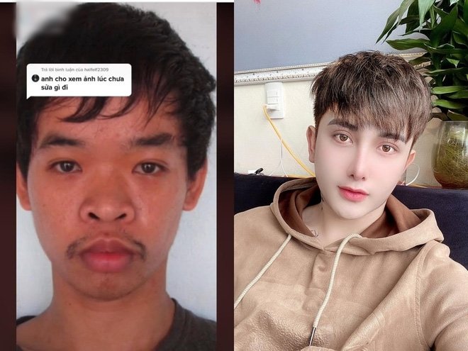 Cosmetic surgery2