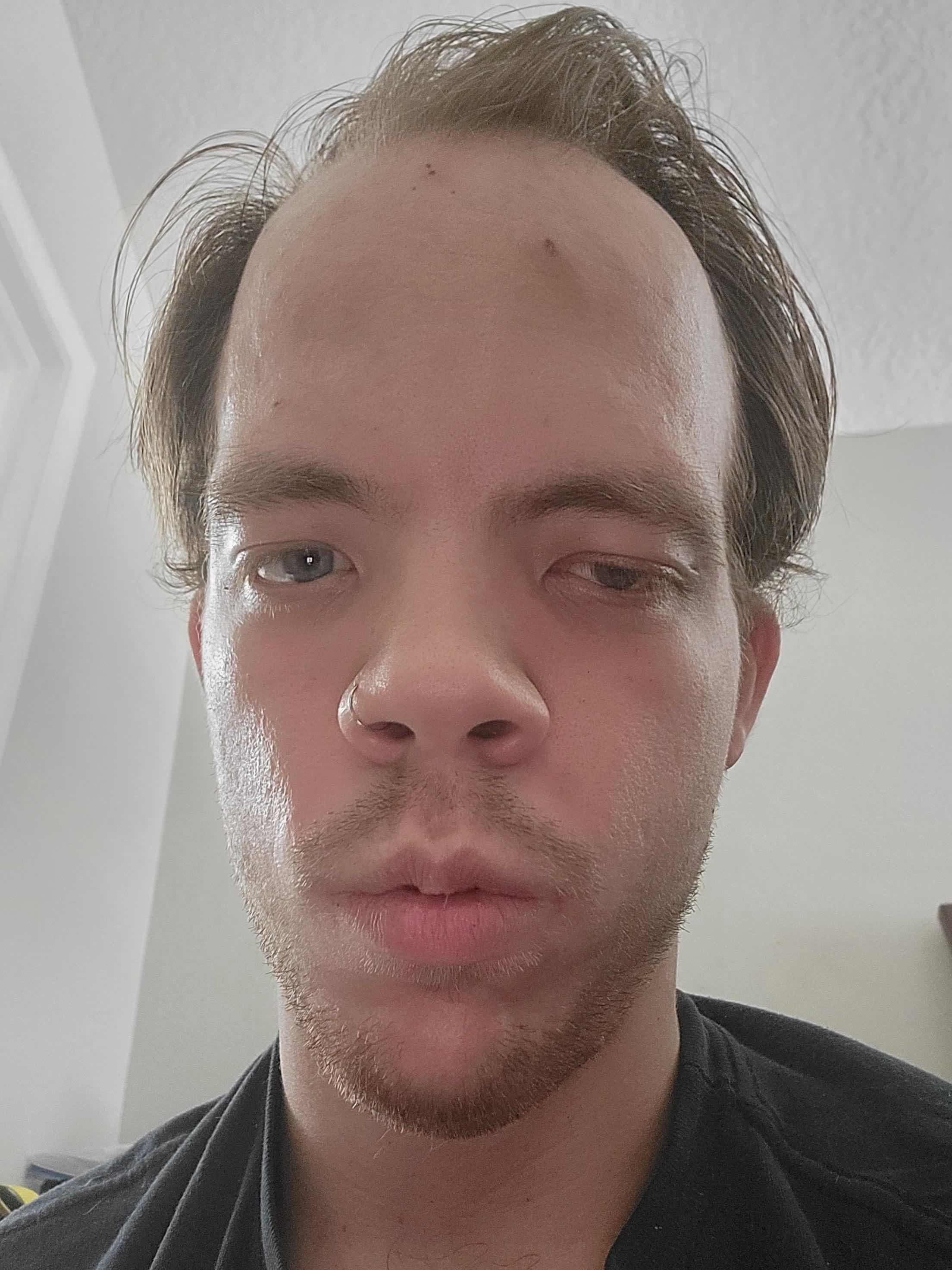 QLTSNRX
