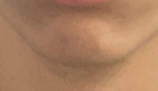 IMG 1754