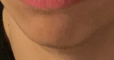 IMG 1753