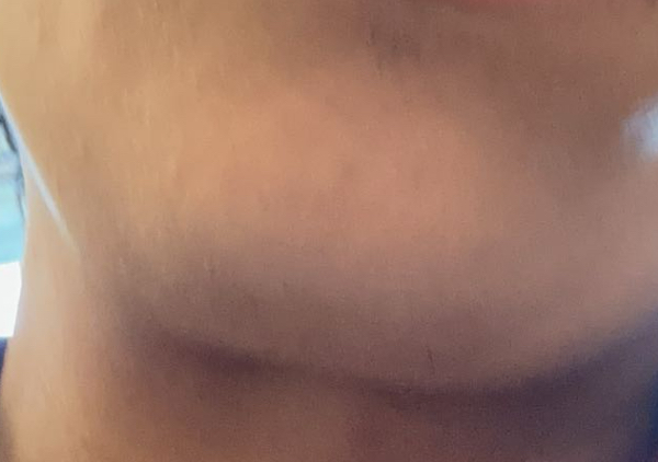 IMG 1750