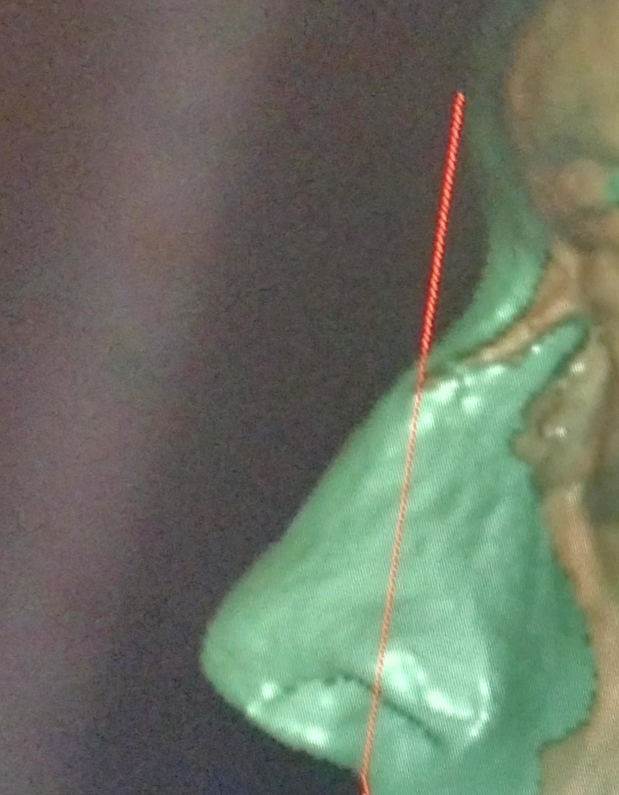 IMG 20231101 185234
