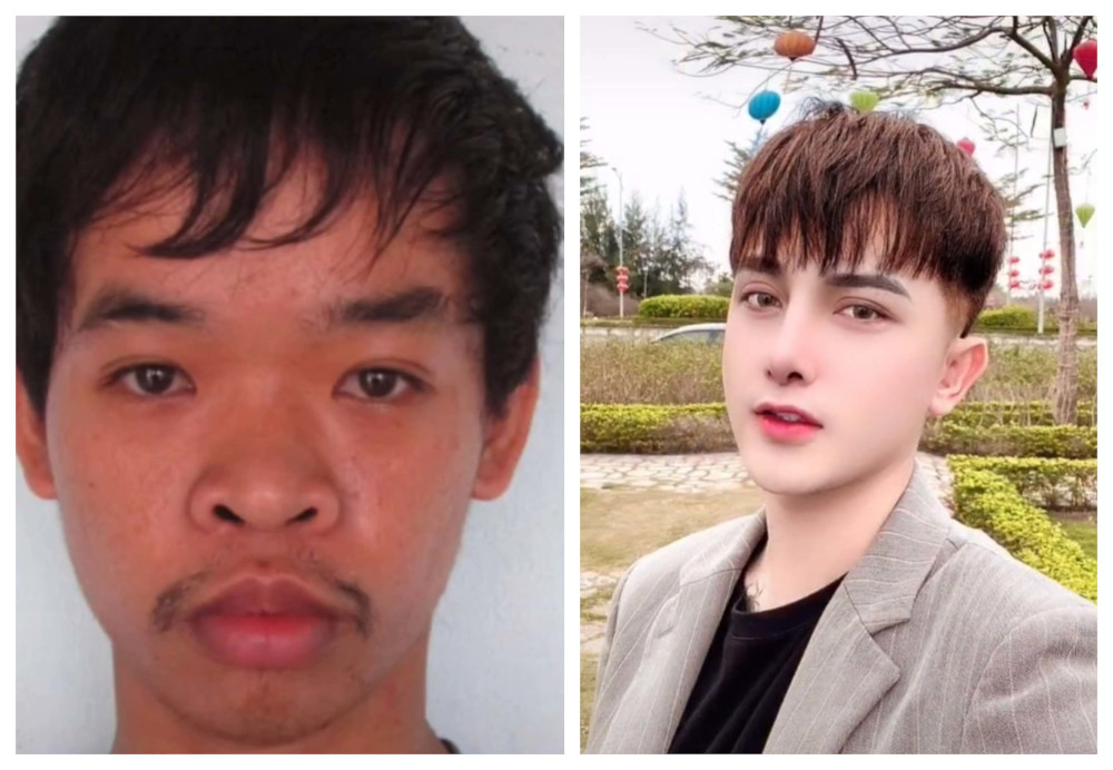 Vietnamese man surgery