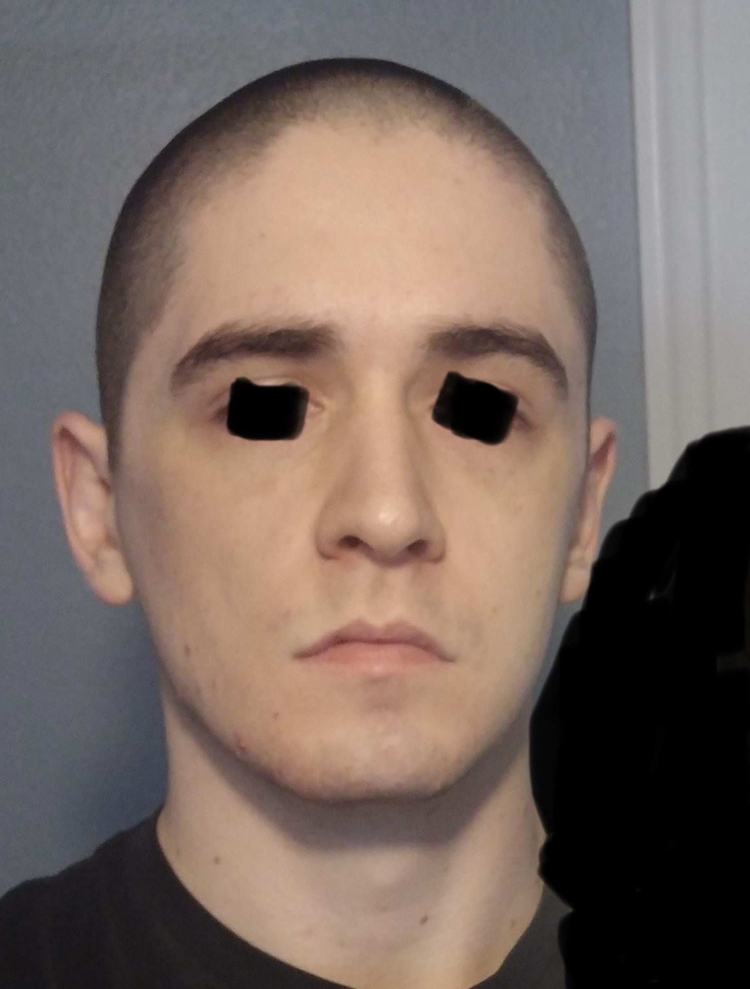 CachedImage